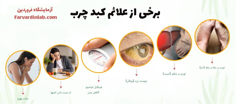 برخی از علائم بیماریهای کبدی