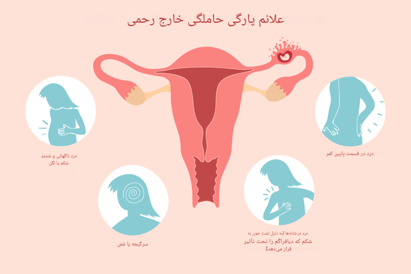 عوارض بعد از عمل حاملگی خارج از رحم