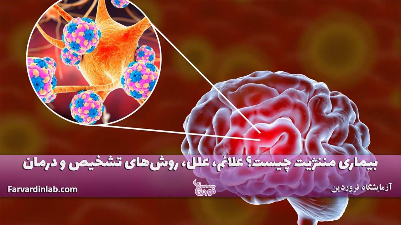 بیماری مننژیت چیست؟