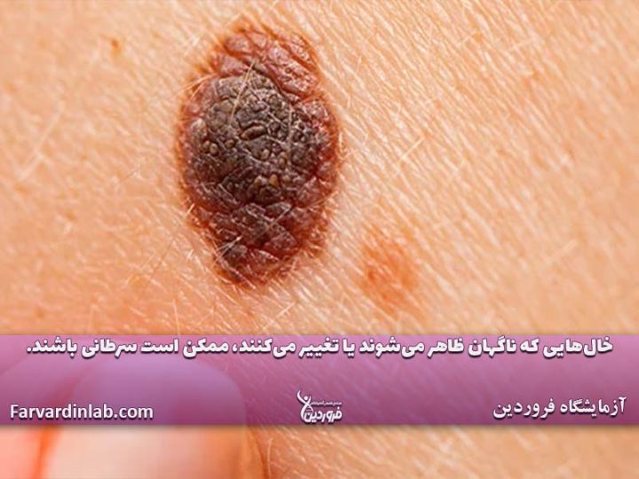 اشعه فرابنفش چیست