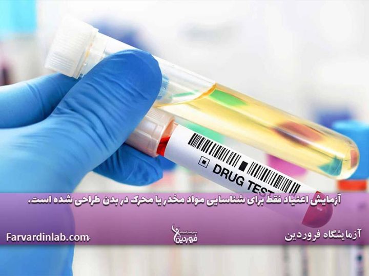 تست ادرار برای چیست؟