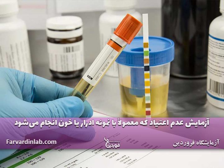 آزمایش عدم اعتیاد