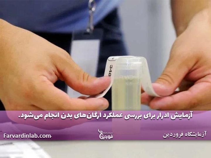 تست اعتیاد برای چیست؟