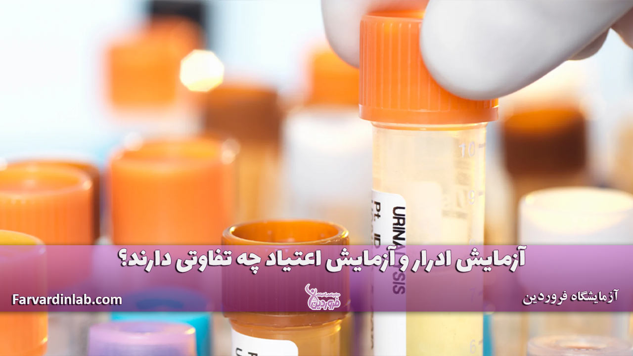 تست اعتیاد و تست ادرار چیست؟