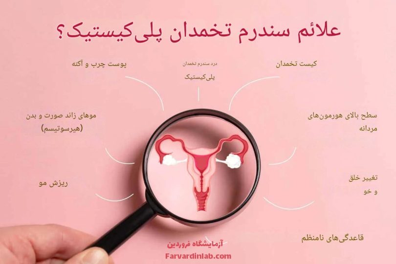 نشانه های تنبلی تخمدان در زنان