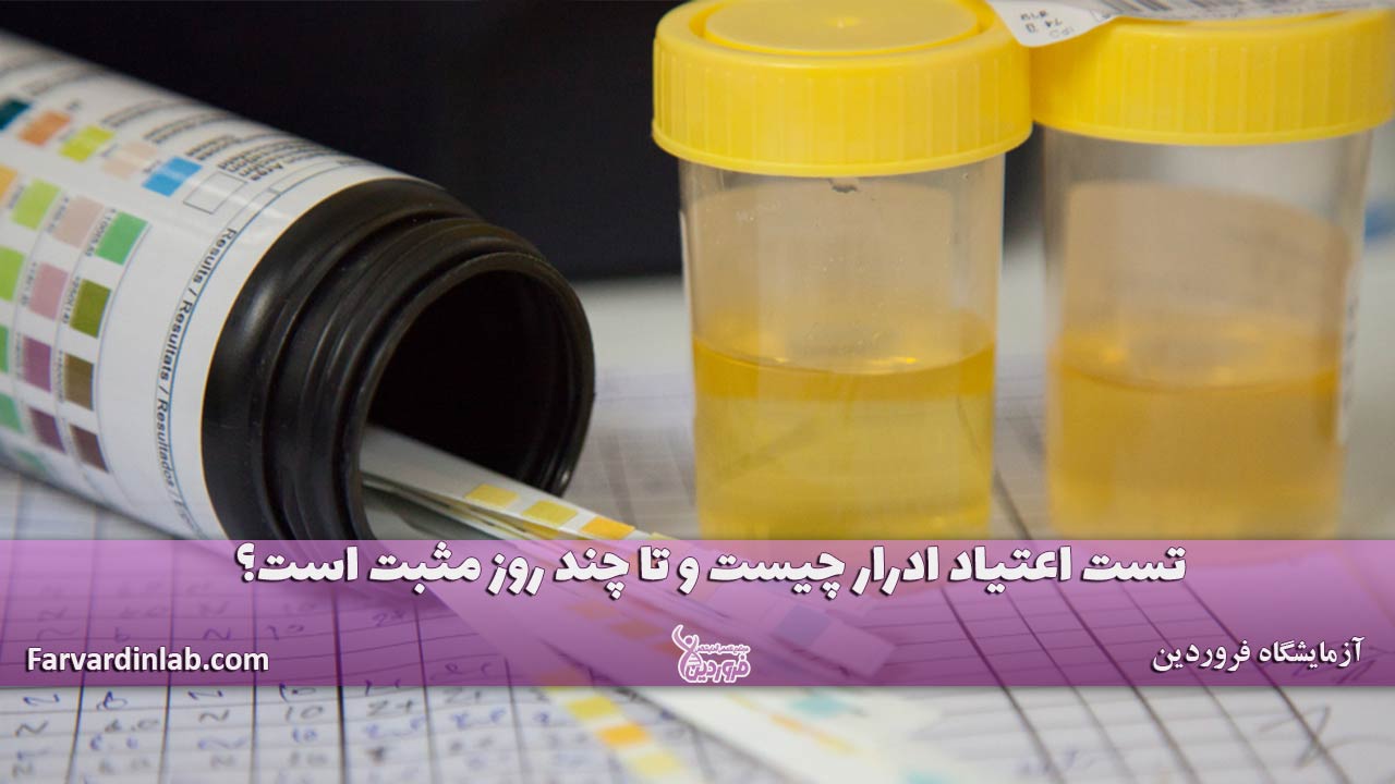تست اعتیاد ادرار چیست؟