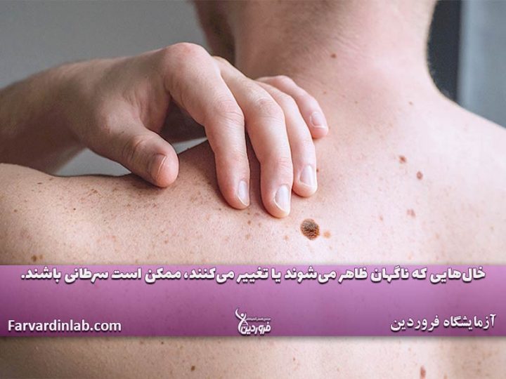 پیشگیری از بیماریهای پوستی