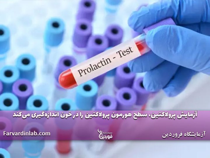 شرایط آزمایش پرولاکتین