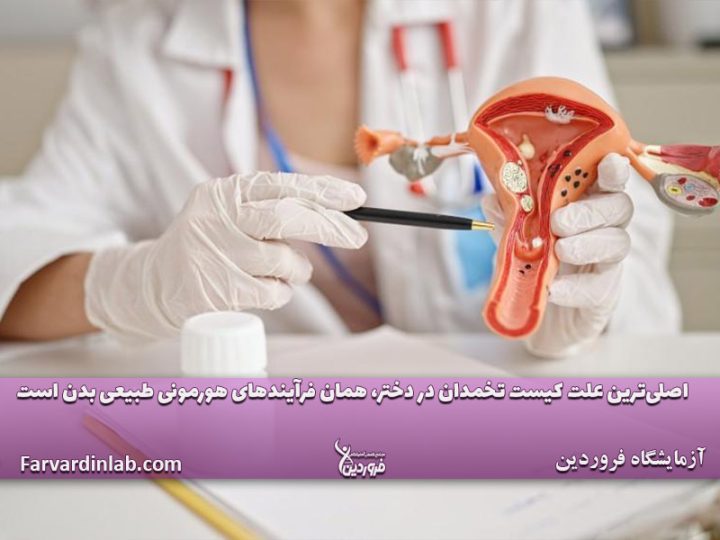 کیست تخمدان چیست