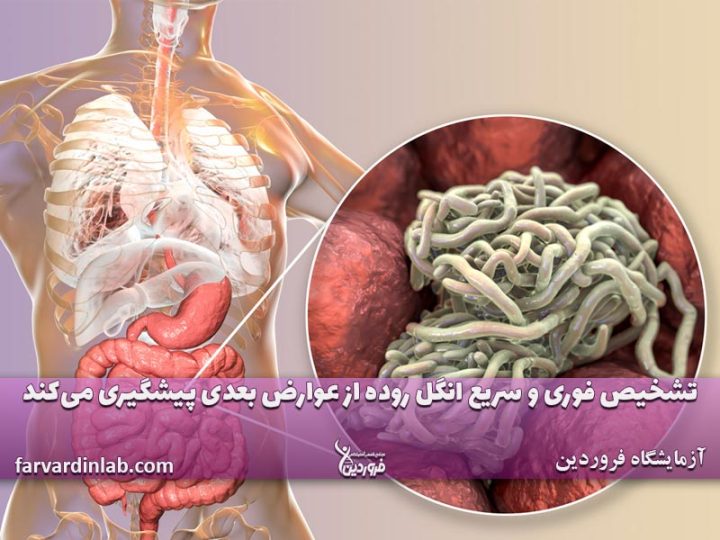 علائم انگل در روده و معده