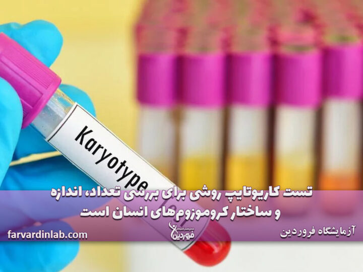 آزمایش کاریوتایپ چیست