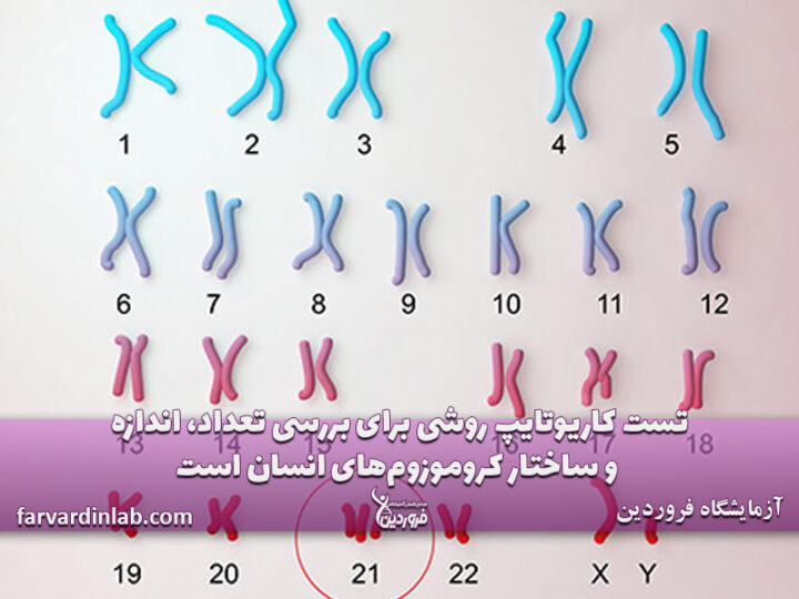 آزمایش کاریوتایپ
