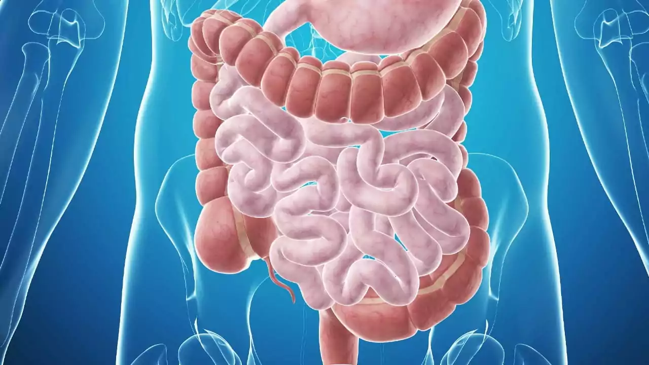 سرطان روده بزرگ