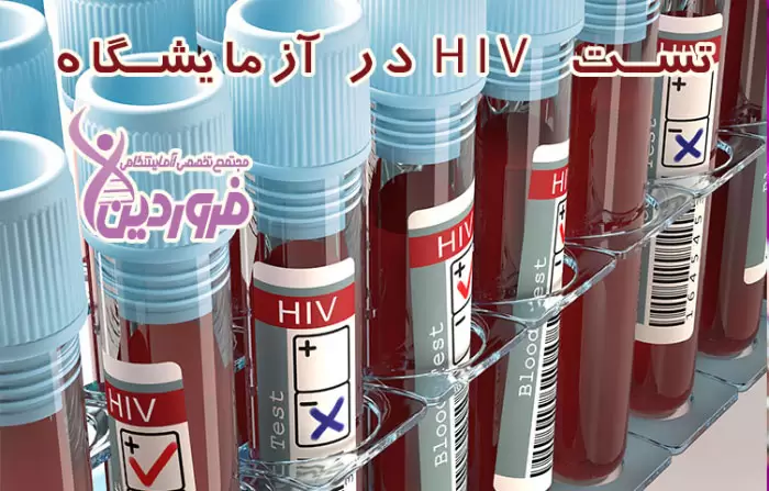 تست ایدز در آزمایشگاه فروردین