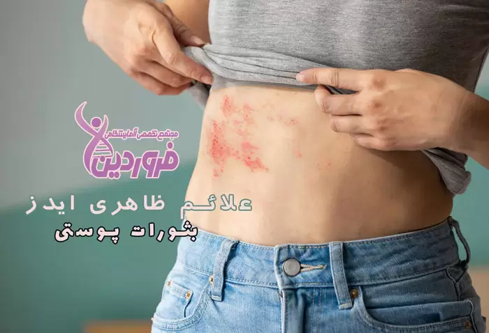 علائم حتمی ایدز چیست