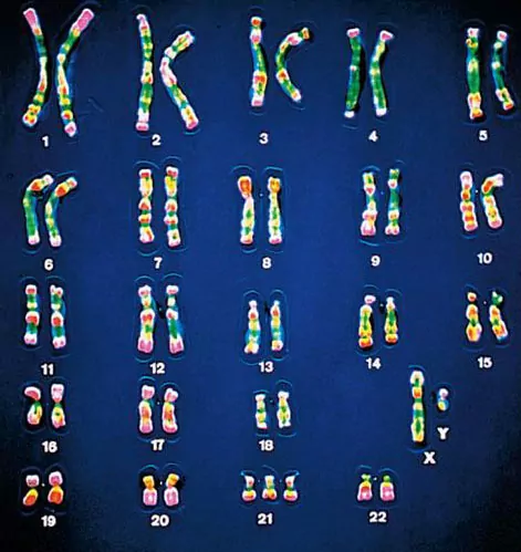 آزمایش کاریوتایپ -  آزمایشگاه فروردین