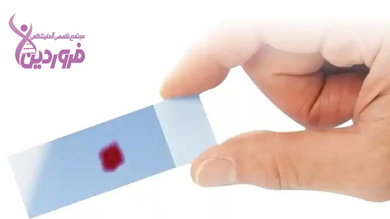 لام خون محیطی