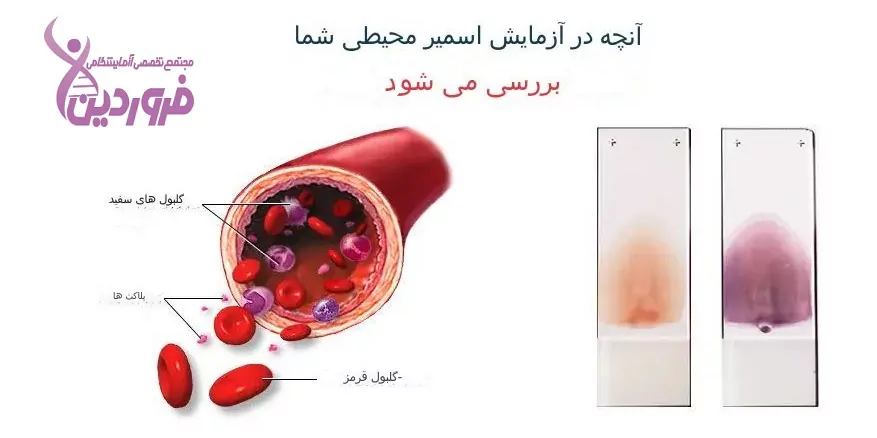 آزمایش اسمیر خون محیطی, آزمایشگاه فروردین