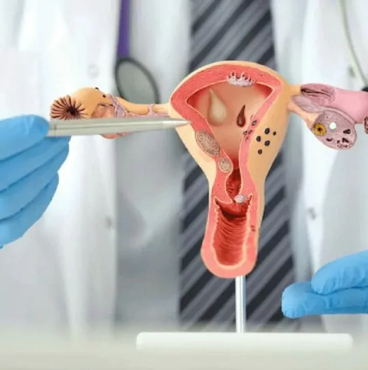 سرطان تخمدان