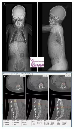 بیمای اس ام ای
