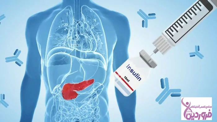 آنتی بادیهای GAD