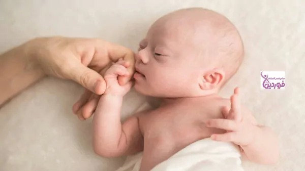 تشخیص سندروم داون در بارداری