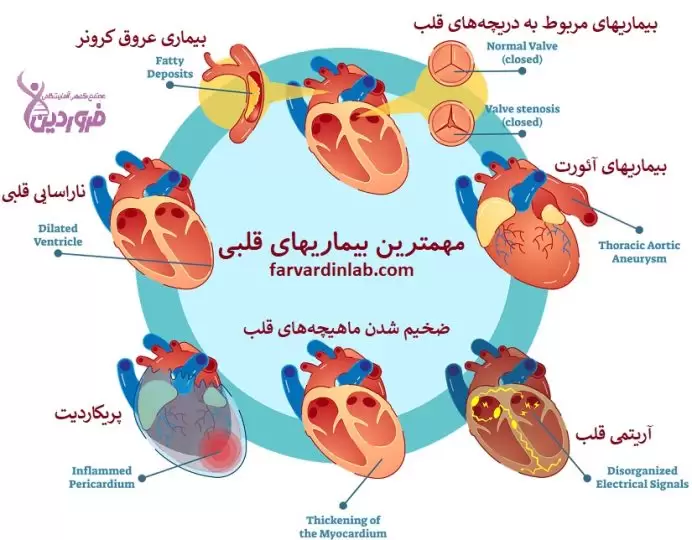 مهمترین بیماریهای قلبی چیست؟