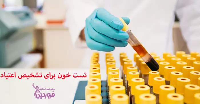 تست خون برای آزمایش اعتیاد ، آزمایشگاه فروردین