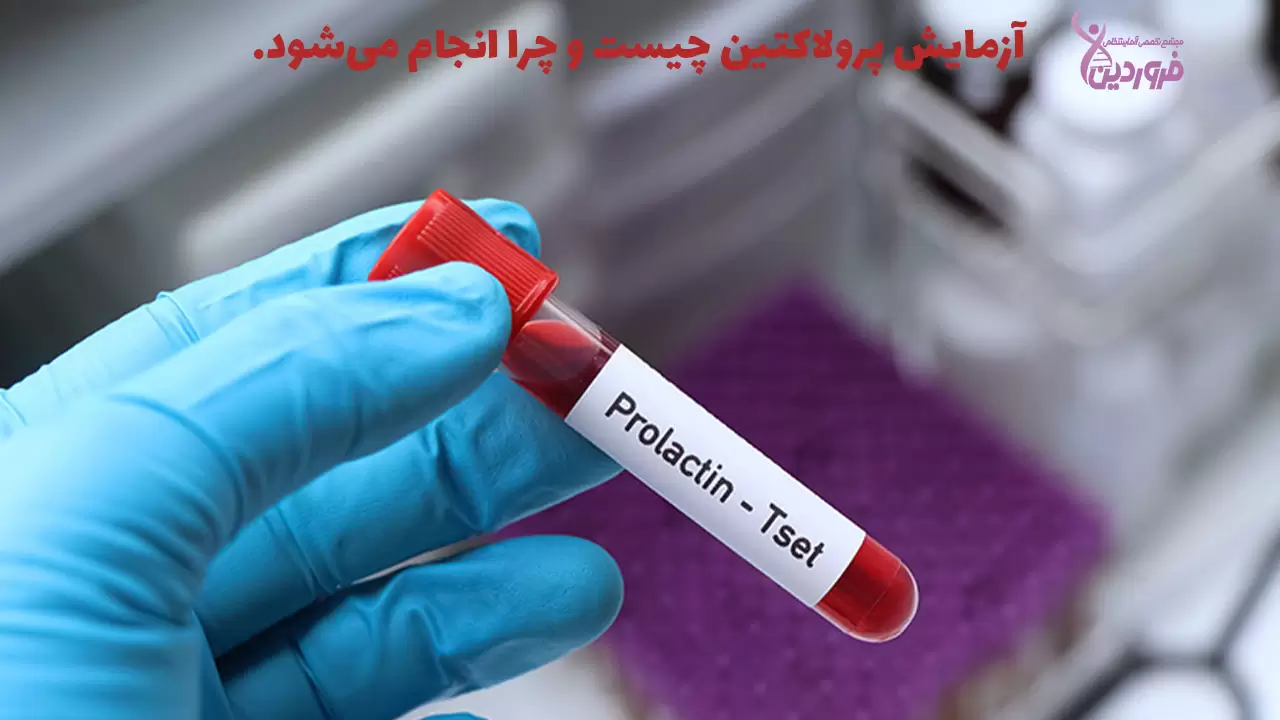 آزمایش پرولاکتین چیست؟
