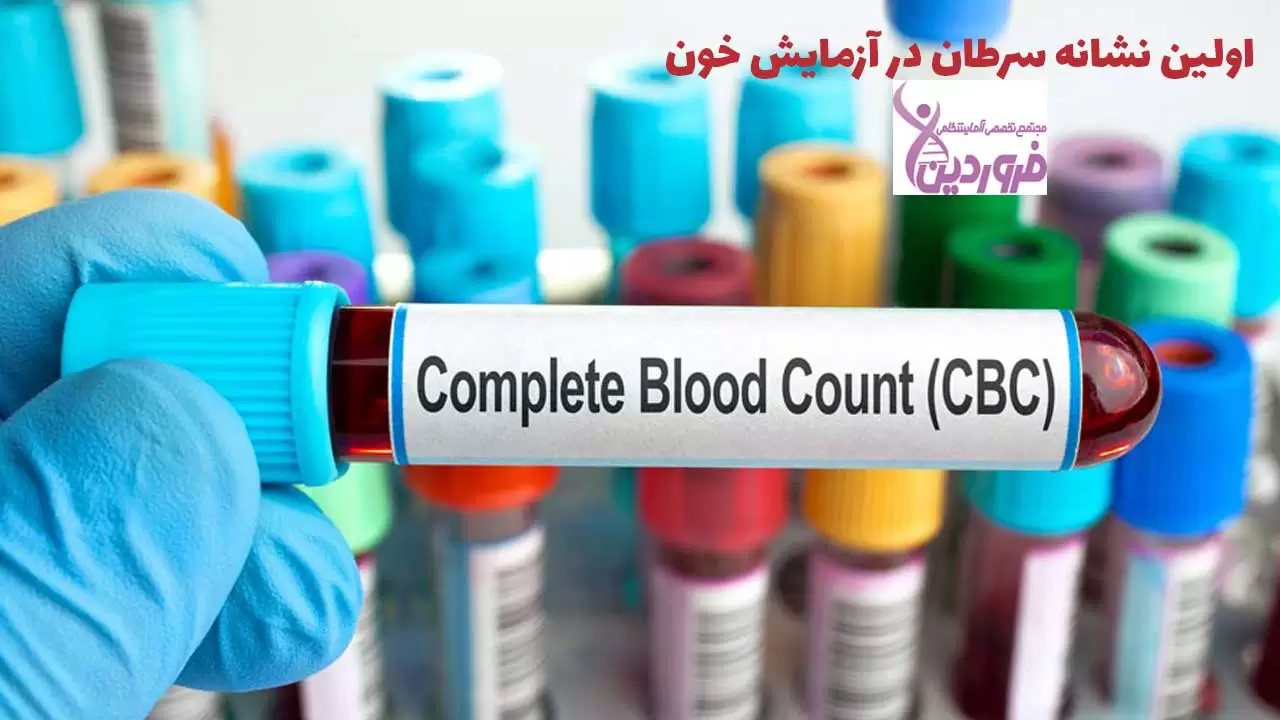 اولین نشانه سرطان در آزمایش خون - آزمایشگاه فروردین