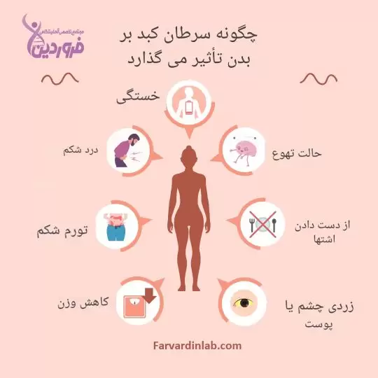 علائم و عوراض سرطان کبد