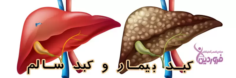کبد سالم و کبد سرطانی