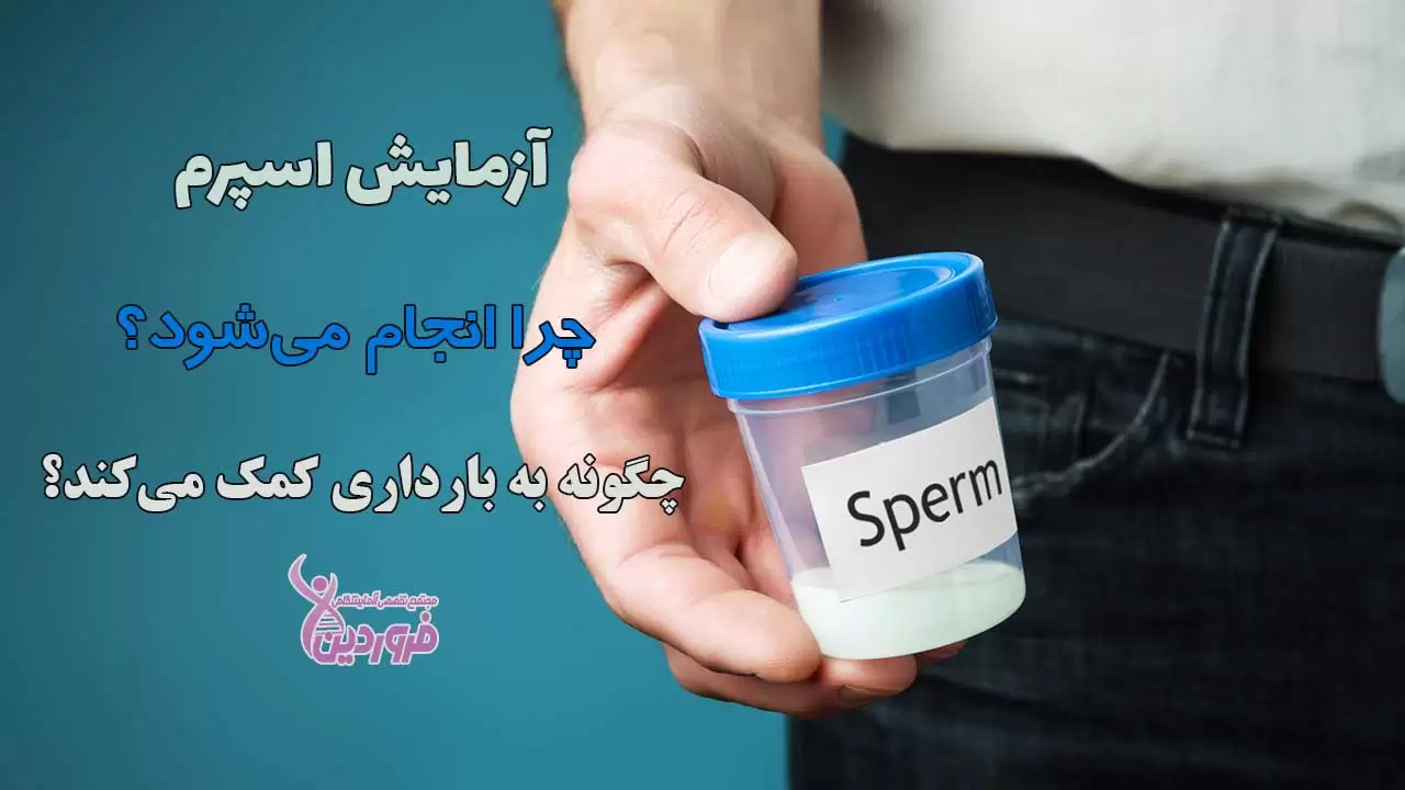 آزمایش اسپرم چرا انجام میشود