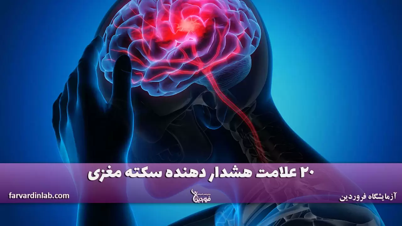 علائم هشداردهنده سکته مغزی چیست