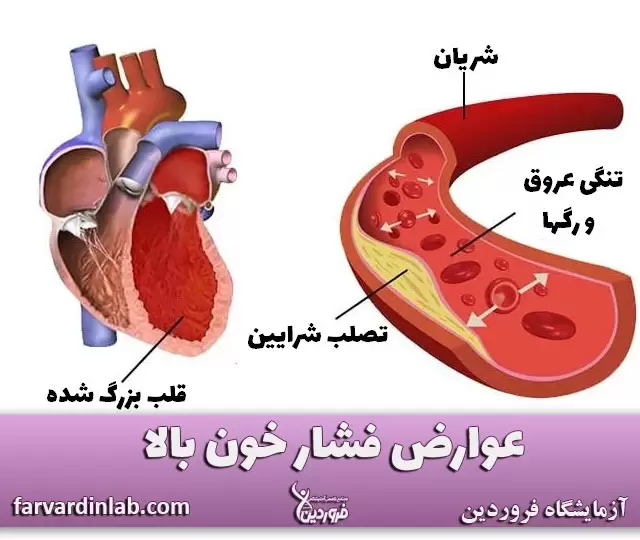عوارض قلبی