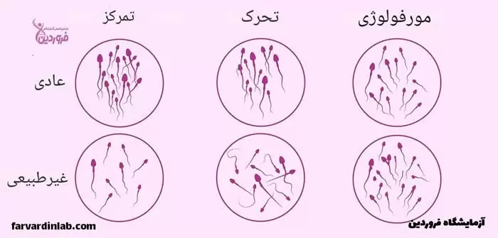 آزمایش منی چطور انجام میشود