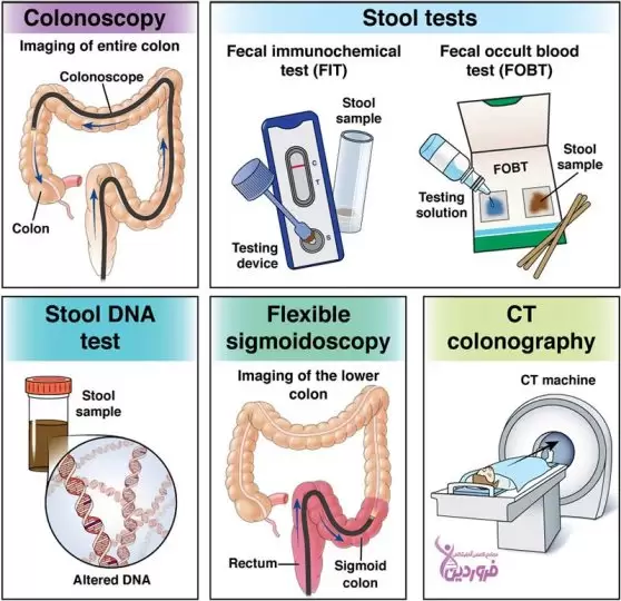 روشهای غربالگری روده
