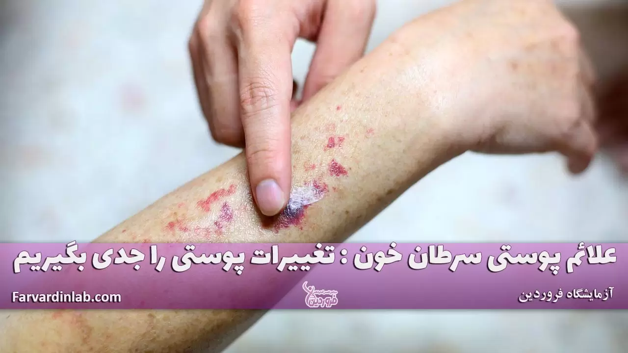 علائم پوستی سرطان خون چیست