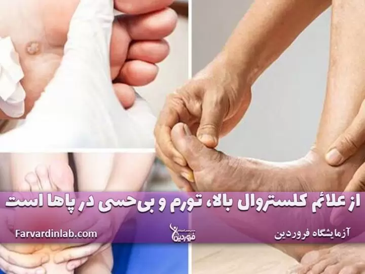 علت بی حسی پاها