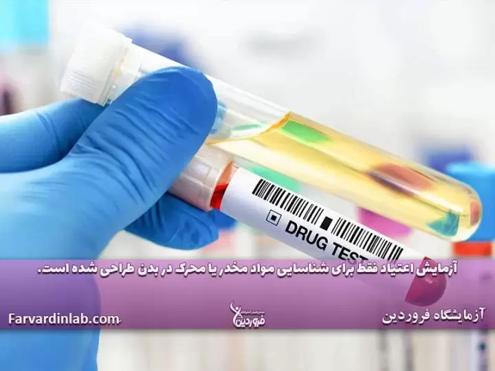 تست ادرار برای چیست؟