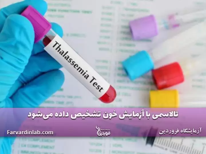 آزمایش تالاسمی